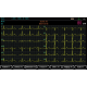 Electrocardiographe ECG Spengler Cardiomate 6 (6 pistes) avec interprétation
