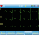 Electrocardiographe ECG Contec 90A (3 pistes) avec interprétation