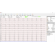 Electrocardiographe ECG Spengler Cardiomate PC-ECG (12 pistes)